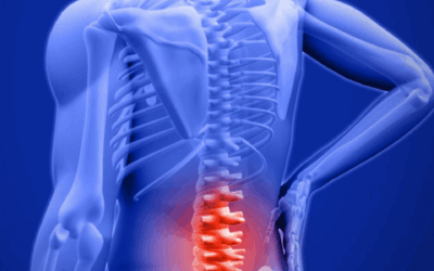 3 types of Pinched Nerves