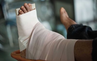 Ankle fusion: How likely are complications?