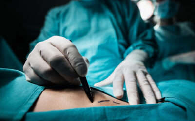 What Surgery did to our last patient (Part 2)