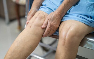 Complications after a total knee replacement