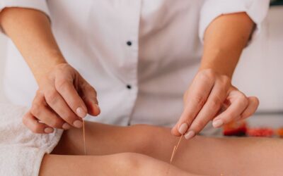 Acupuncture for knee pain: Does it work?