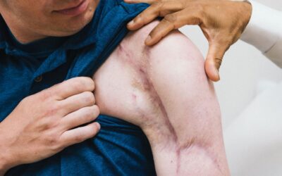 The second shoulder OP: Will you come out better?